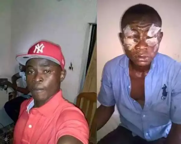 Man Left Blinded After He Was Attacked With Acid (See Graphic Photos)